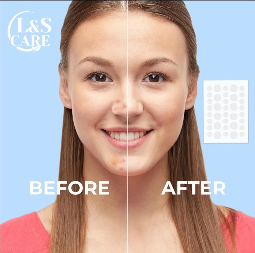 ACNE PATCH WITH ESSENTIAL OILS